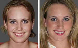 Smile Makeovers offer Health & Beauty